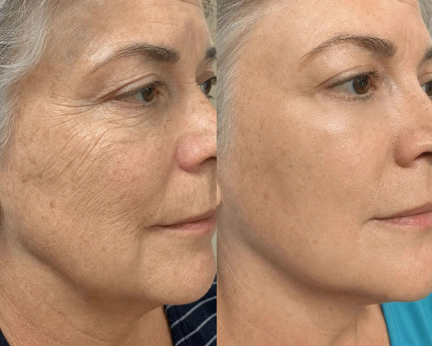 Before and after result 1